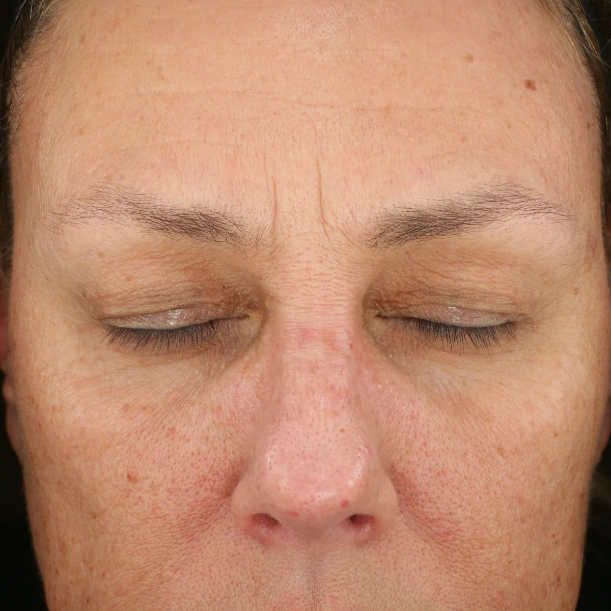 Senté Dermal Repair Cream After