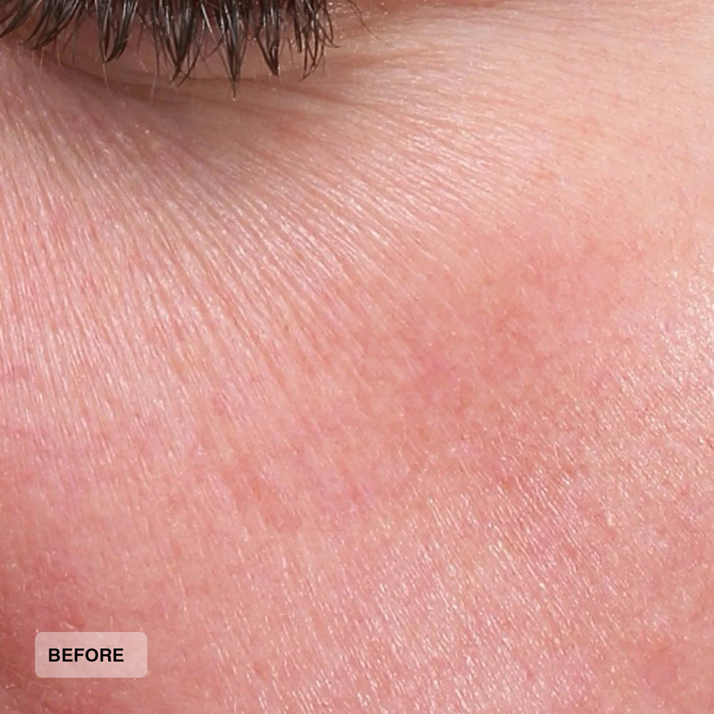 Senté Hydrate+ Serum Before