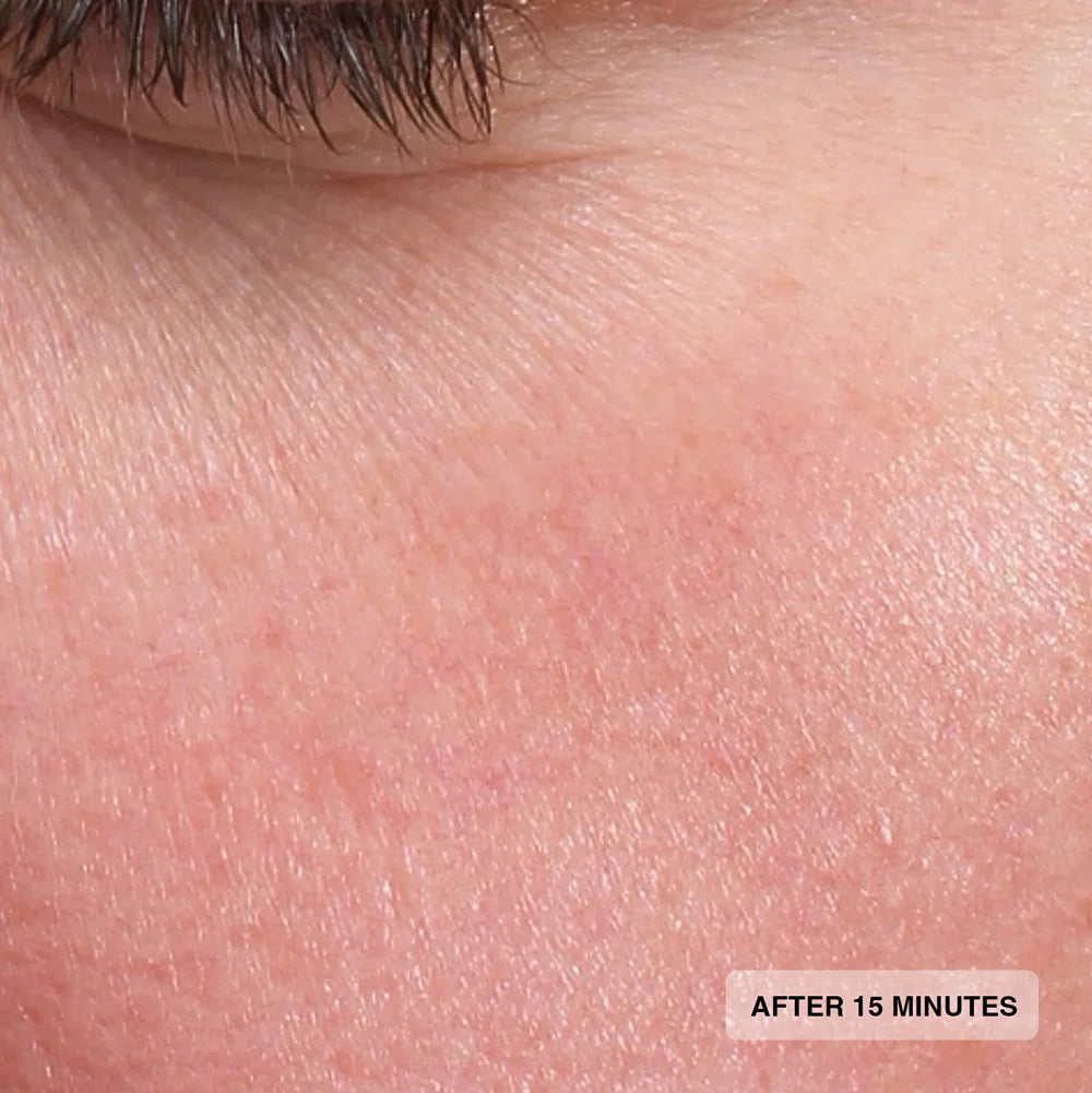 Senté Hydrate+ Serum After