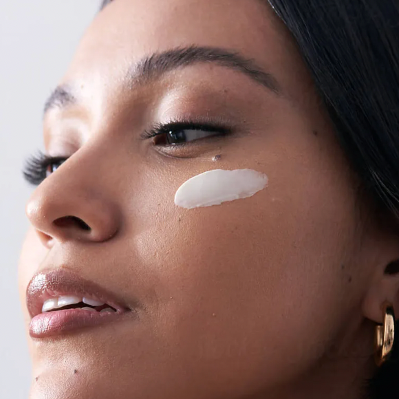 model victoria showing cream application on cheek