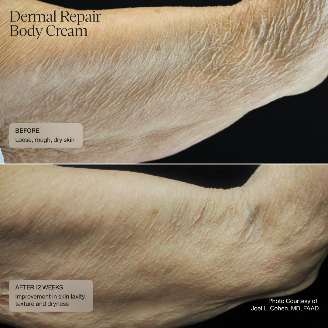Senté Dermal Repair Body Cream Before & After