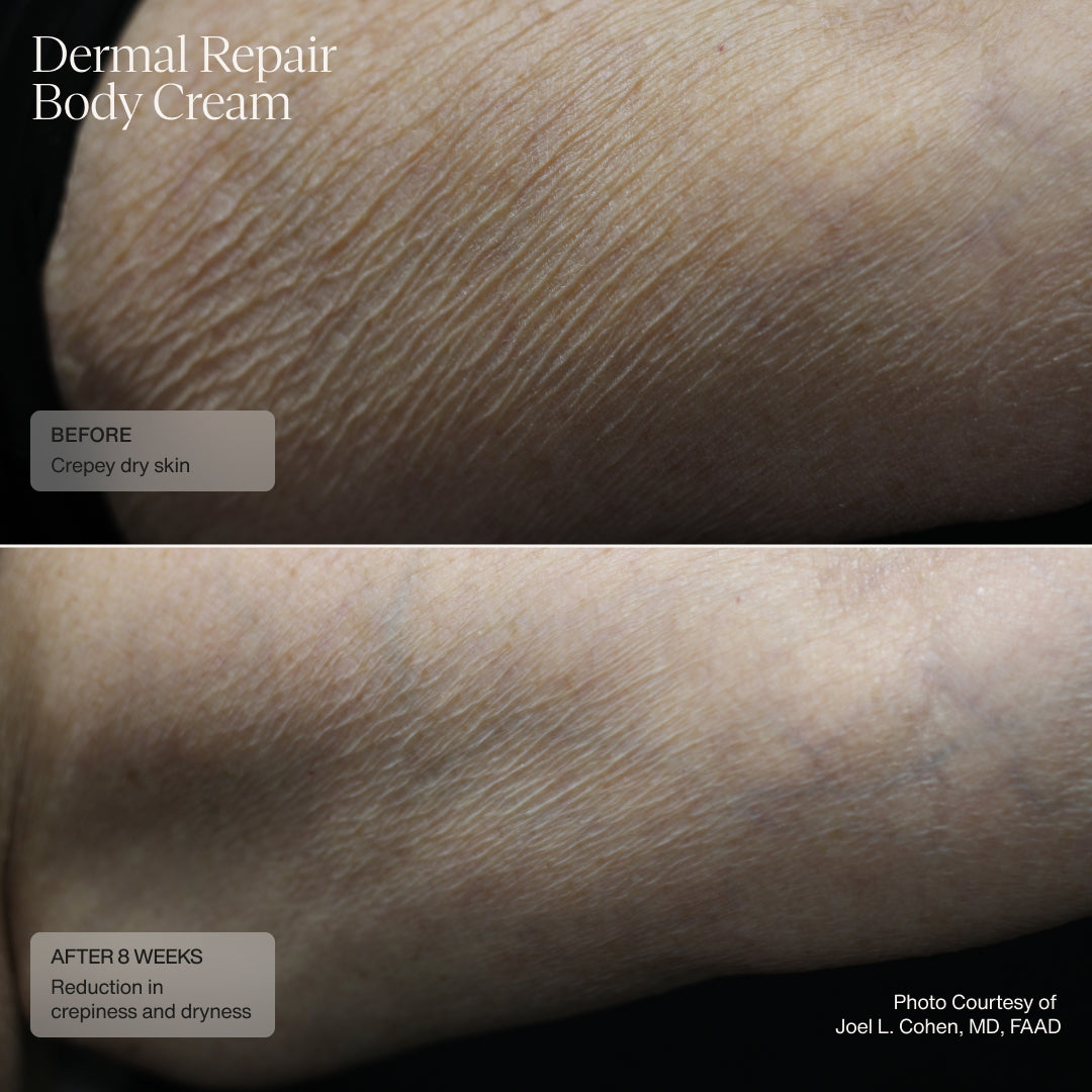 Senté Dermal Repair Body Cream Before & After