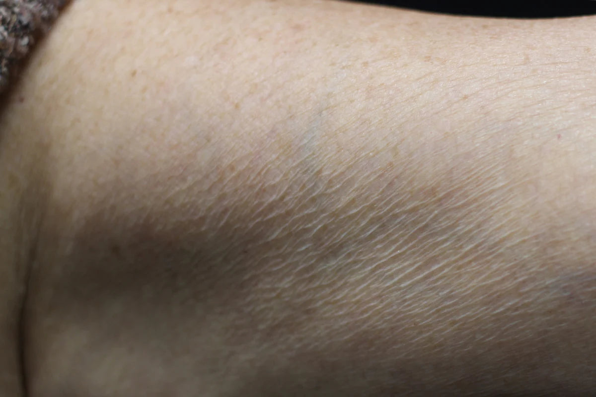 Senté Dermal Repair Body Cream After