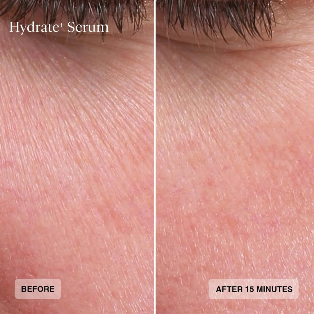Senté Hyrate+ Serum Before & After